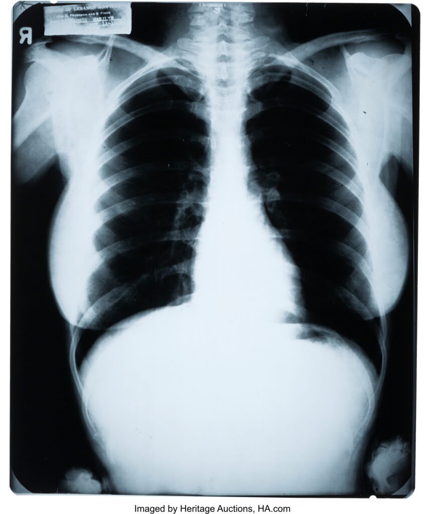 Marilyn Monroe’s X-rays