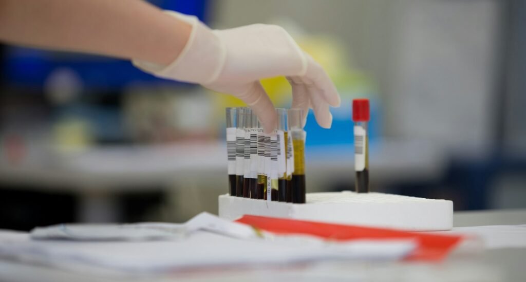 blood-sample-donation-credit-Adrian-Sulyok-on-Unsplash